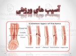 پاورپوینت آسیب های ورزشی