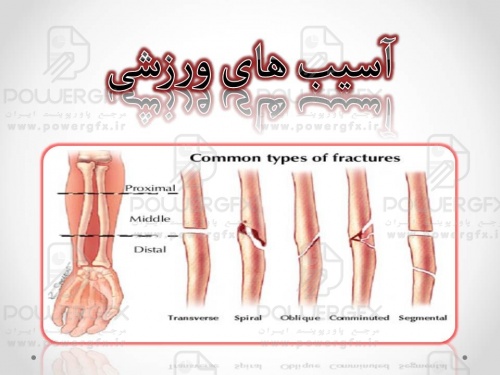 پاورپوینت آسیب های ورزشی